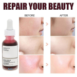 سرم پیلینگ سولوشن حاوی AHA 30% و BHA 2%