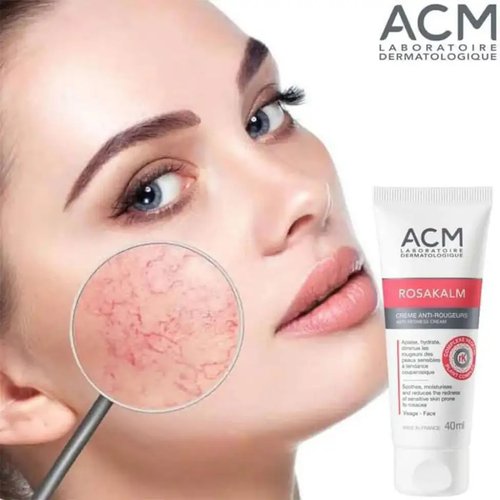 کرم ضد التهاب و ضد قرمزی صورت و گردن ای سی ام