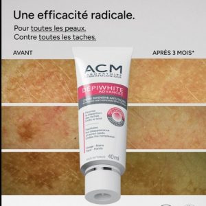 کرم ضد لک دپی وایت ای سی ام